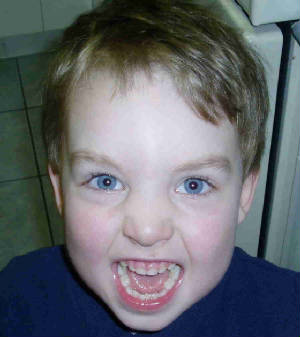 gregteeth.jpg